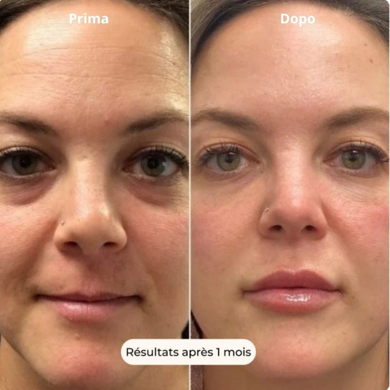 Patchs Hydralift (8 paires)