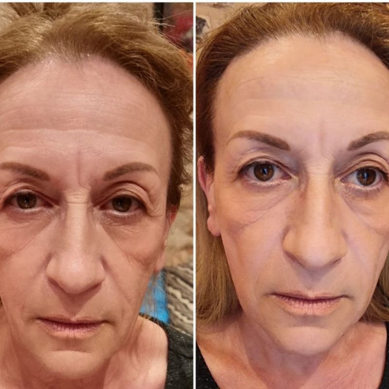 DrainLift® Spazzola Drenante Linfatica Viso