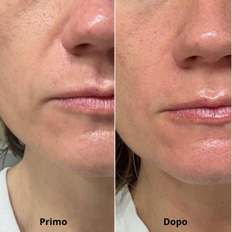 GlowLift™ Stick PDRN
