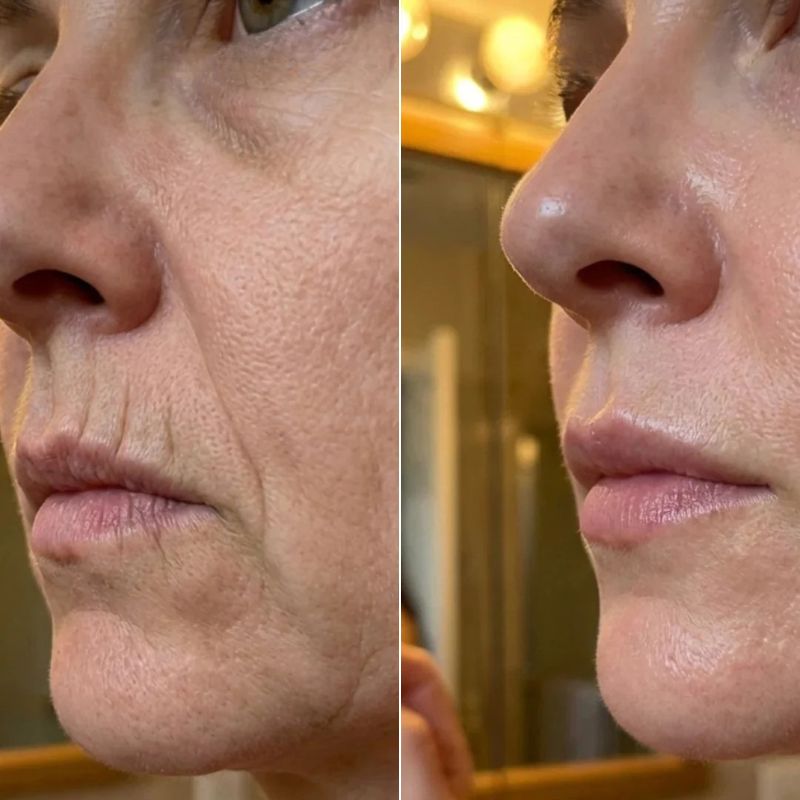 GlowLift™ Stick Collagene & PDRN