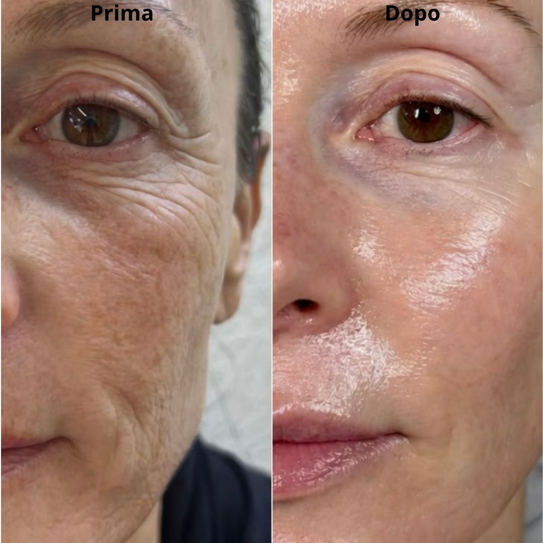 Maschera BIO-Collagène Intensa- Pack de 4