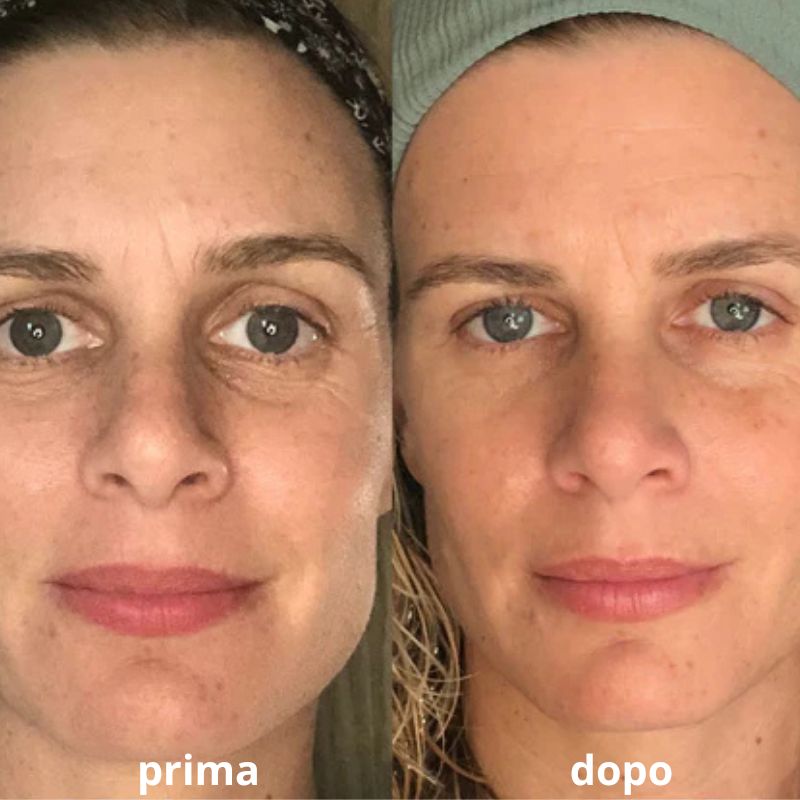DrainLift® Spazzola Drenante Linfatica Viso