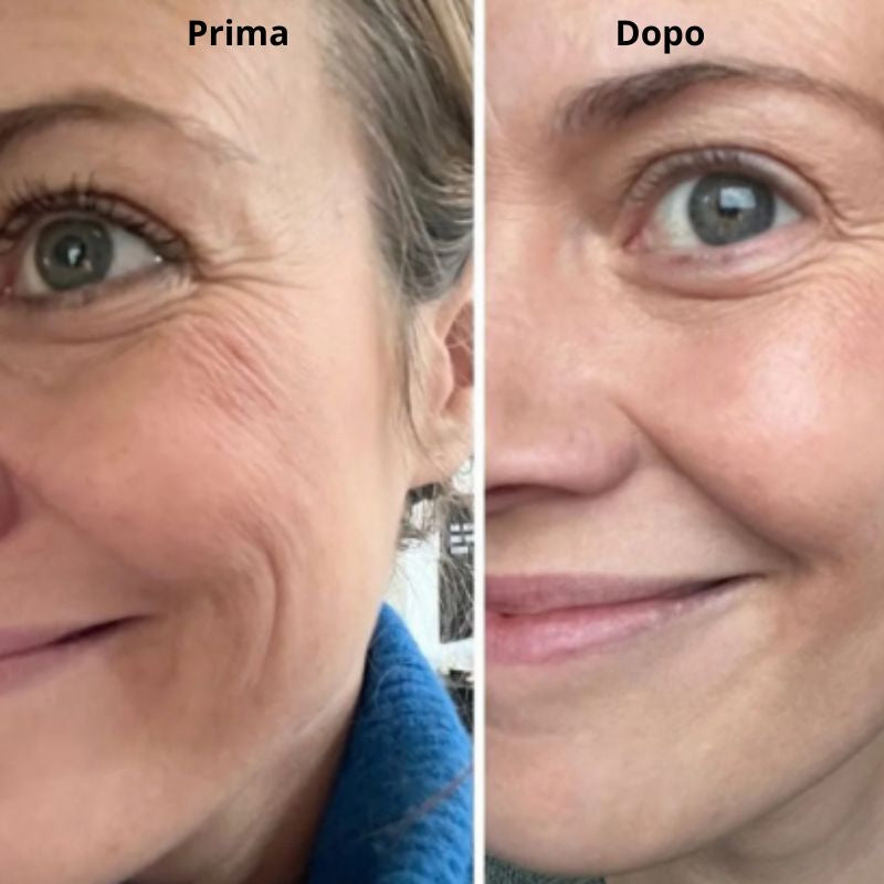 4 Maschere viso BIO-COLLAGENE