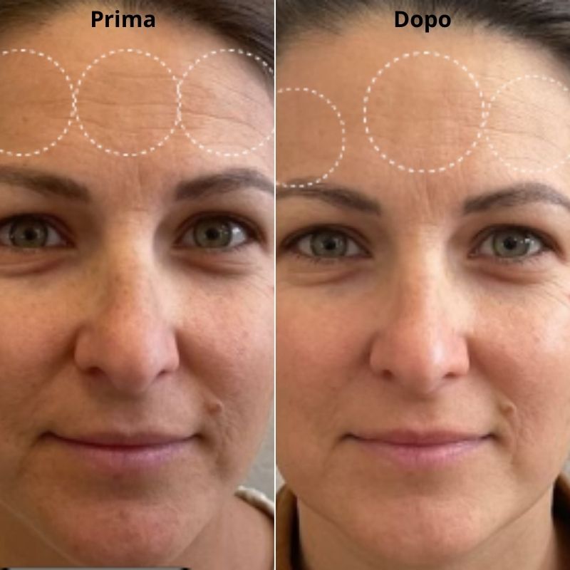 4 Maschere viso BIO-COLLAGENE