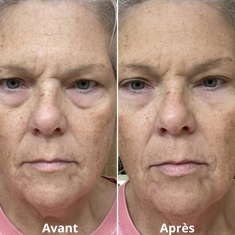 FLASHLift® Contorno occhi effetto lifting immediato