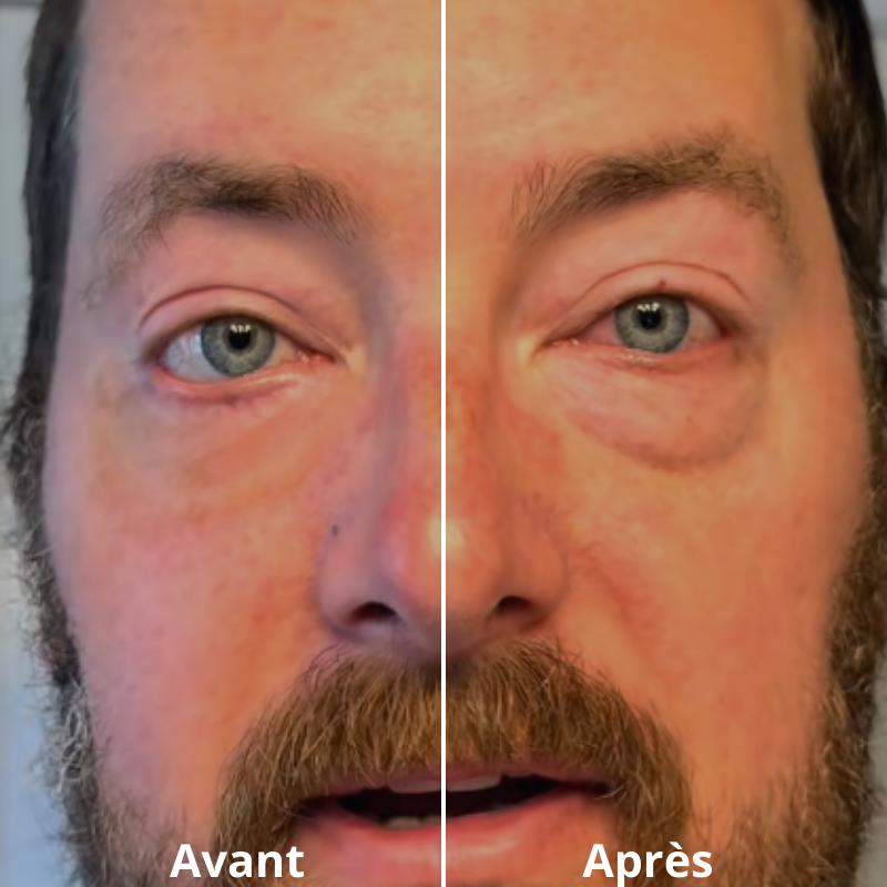 FLASHLift® Contorno occhi effetto lifting immediato