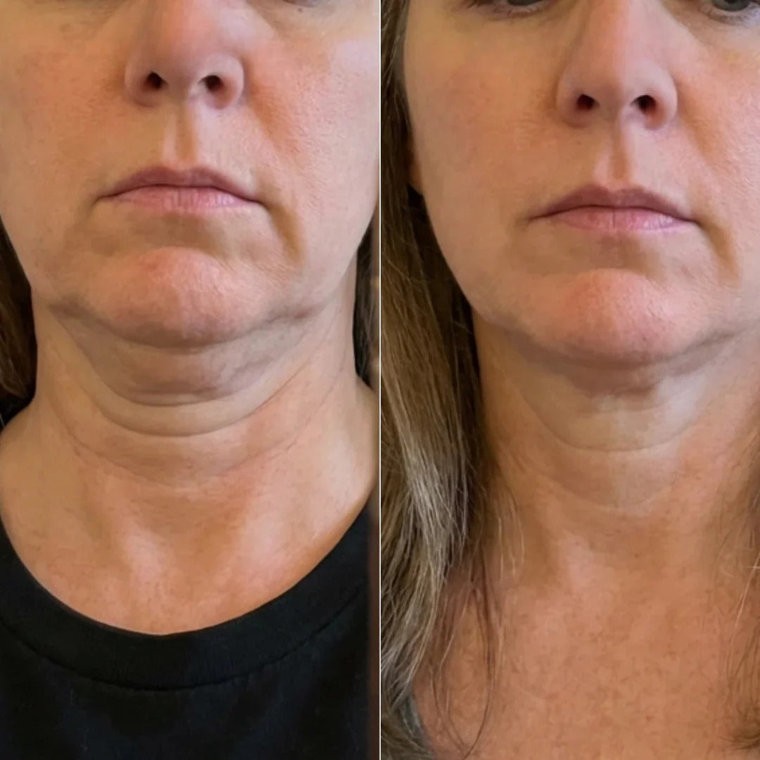 GlowLift™ Stick PDRN