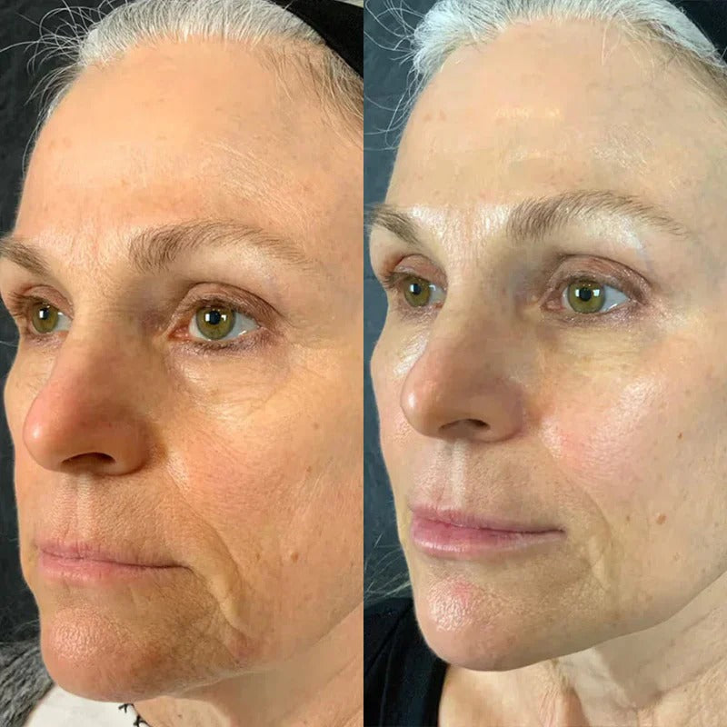 GlowLift™ Stick Collagene & PDRN